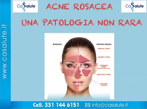 Acne rosacea